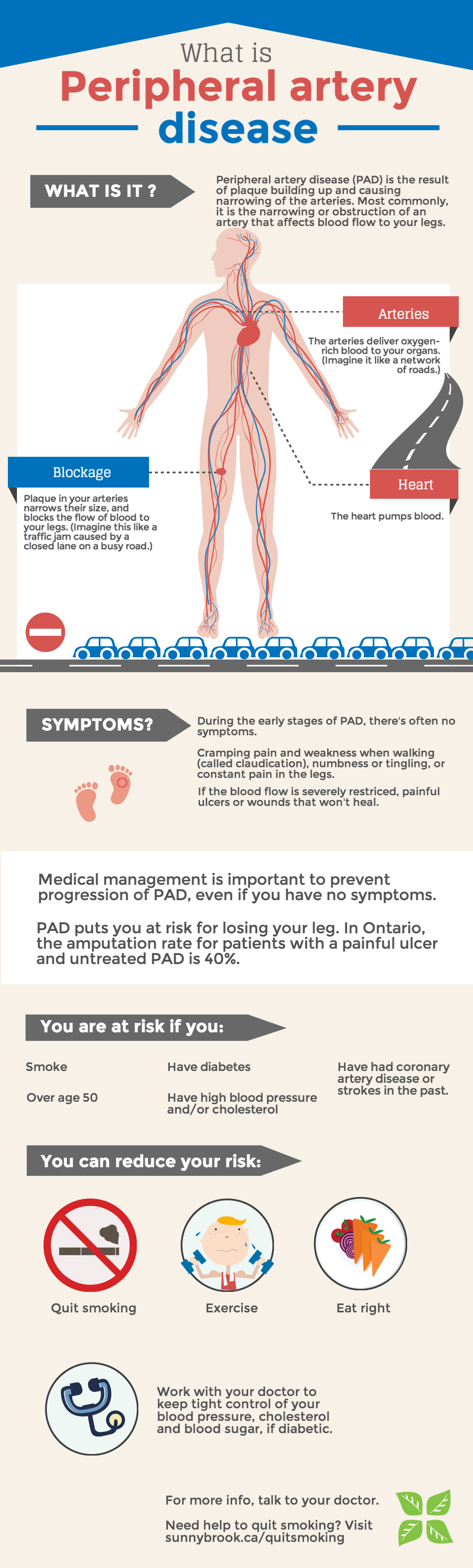 Is Peripheral Artery Disease Bad