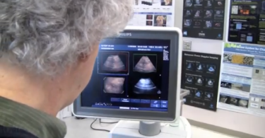Researcher using bubbles to find cancer in a patient