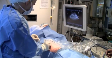 Doctor using ultrasound