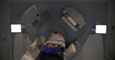 Patient receiving radiation therapy