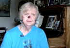 Cancer survivor without prosthetic nose