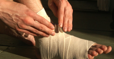 Sprained foot wrapped in bandage