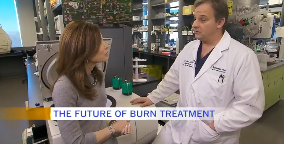 CTV's Dr. Marla and Sunnybrook's Dr. Jeschke talking about burn treatment