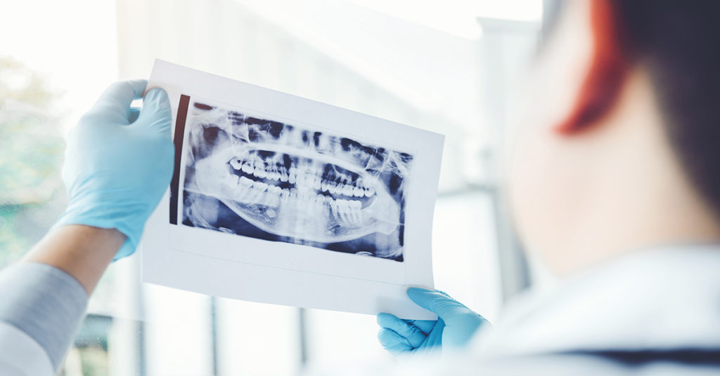 How many dental Xrays are too many?
