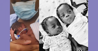 Danielle holds her premature babies on her body in a photo on the left. On the right, a photo of her babies now