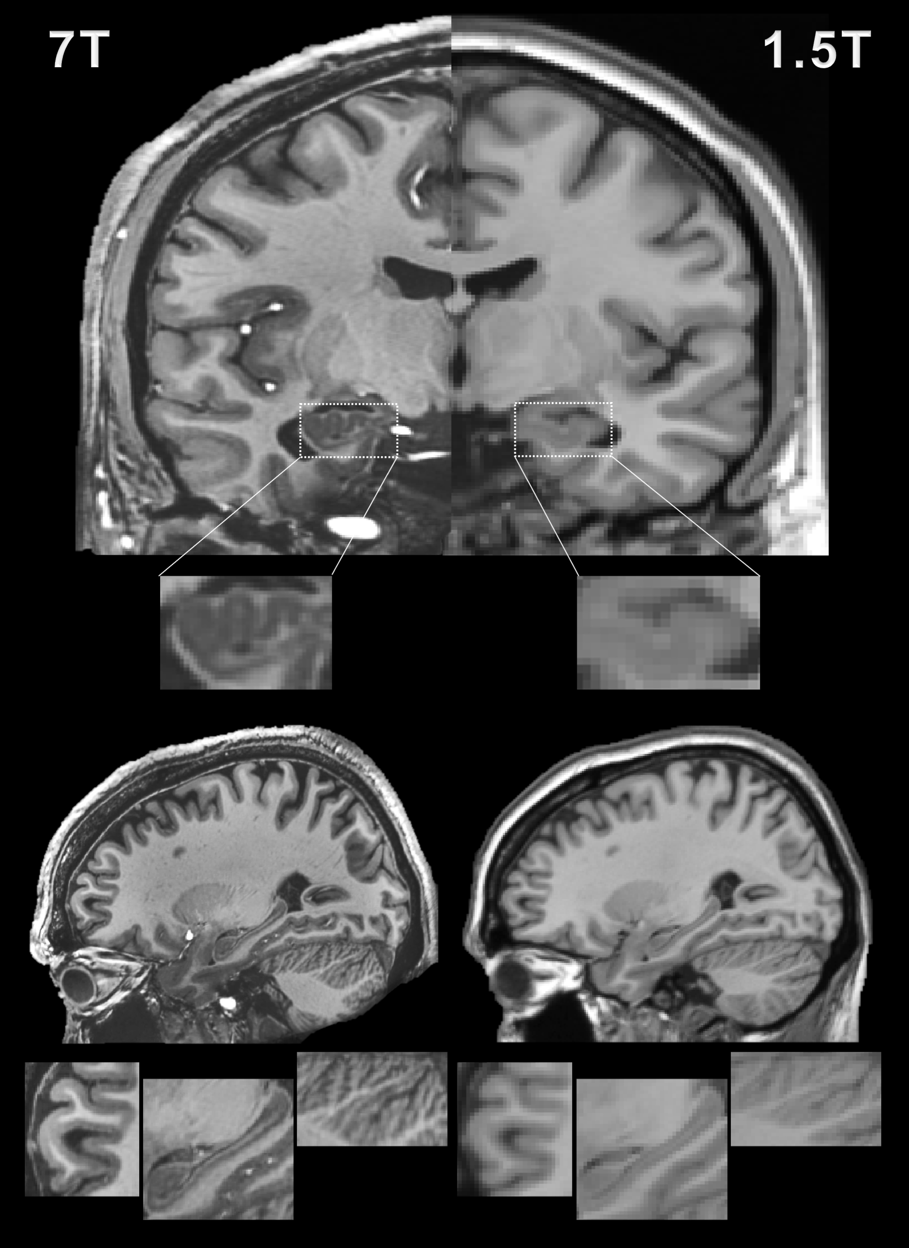 brain scan from 7T MRI