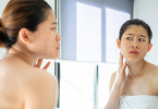 Woman looking at acne in the mirror