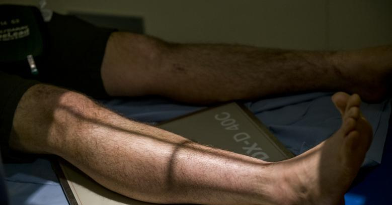 Image of male legs on hospital bed.